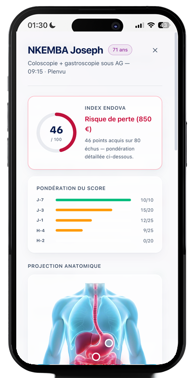 Fiche patient Endova sur téléphone : index de préparation, pondération du score de J-7 à H-2, projection anatomique